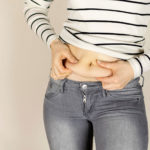 Bauchdeckenstraffung-frau